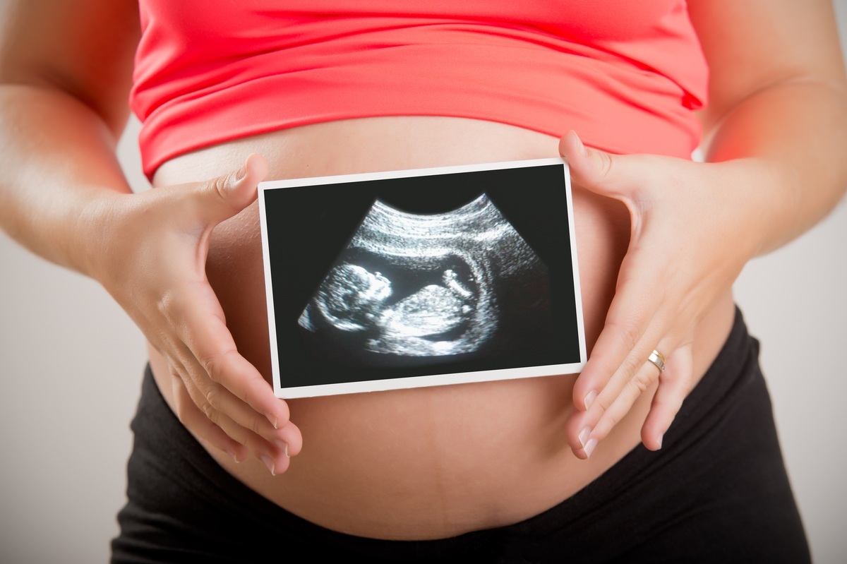 Mulher grávida segurando imagem do ultrassom - foto: ruigsantos/ShutterStock.com