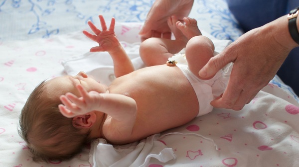  Cerca 30% dos bebês prematuros nascem com hérnia inguinal 