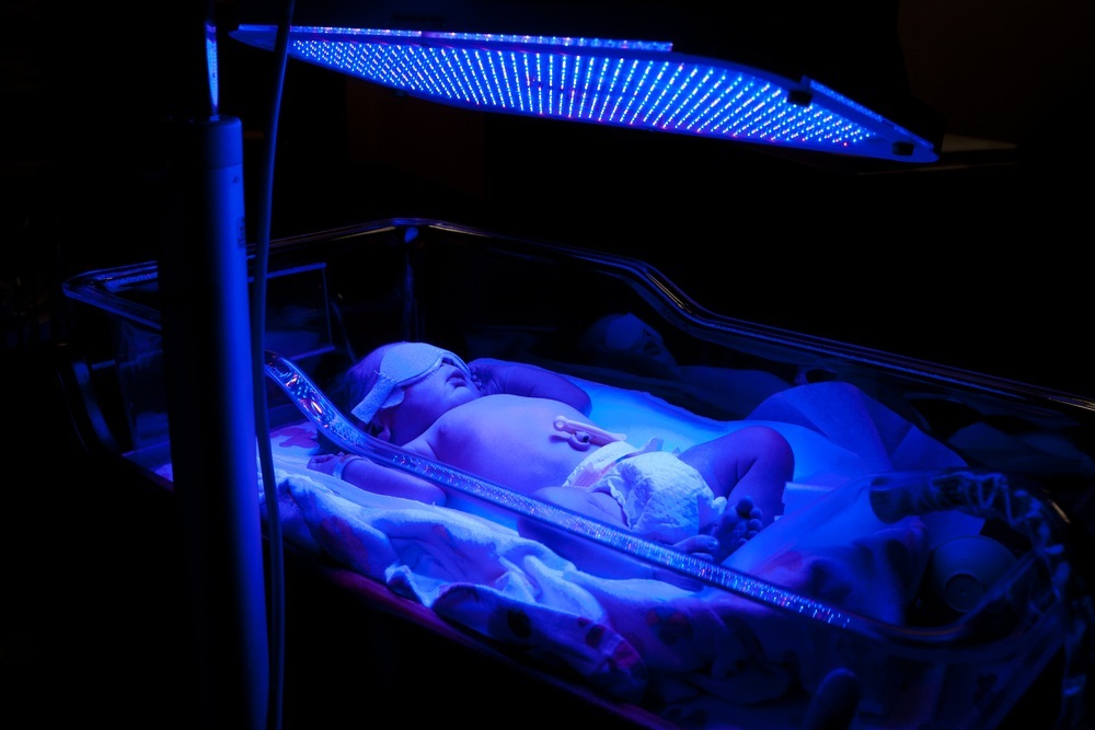 Bebê recém-nascido com icterícia recebendo banho de luz UV para fototerapia - foto: Paul Hakimata Photography/ShutterStock.com