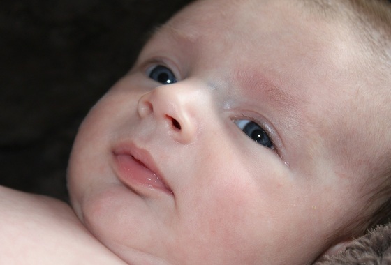 Lacrimejamento excessivo em bebês pode ser sinal de obstrução do canal lacrimal - Foto: TaniaVdB / pixabay.com