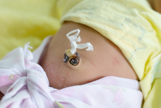 Cordão umbilical de um bebê com 4 dias de vida - foto: Singkham/ShutterStock.com