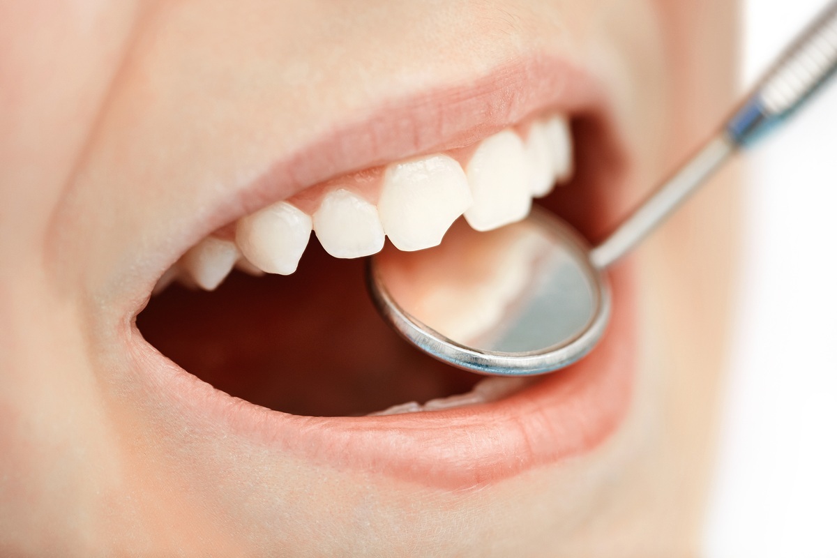 Dentista examinando boca com dente quebrado - foto: Pressmaster/ShutterStock.com