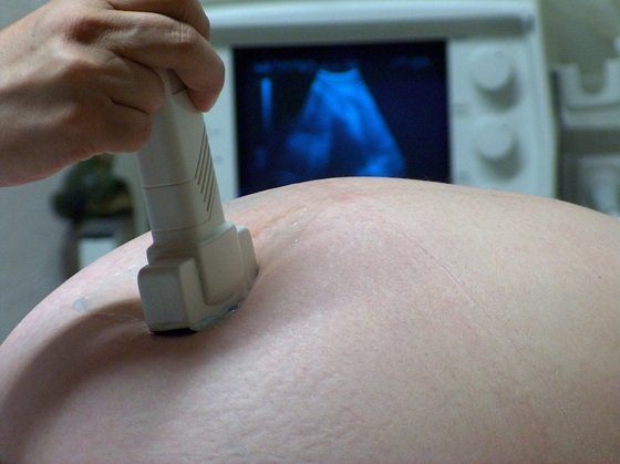 exame de ultrassom na mulher grávida - foto: jess lis jess lis/FreeImages.com