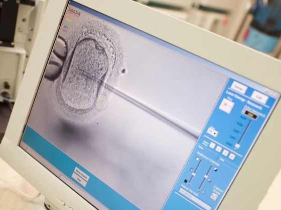 Monitor mostrando o espermatozoide sendo injetado no citoplasma do óvulo (ICSI) - Foto: Monkey Business Images/Shutterstock.com