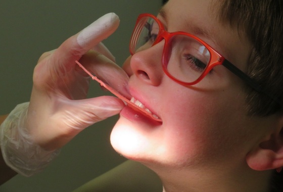 acidentes com dentes das crianças - Foto: bigbear / pixabay.com