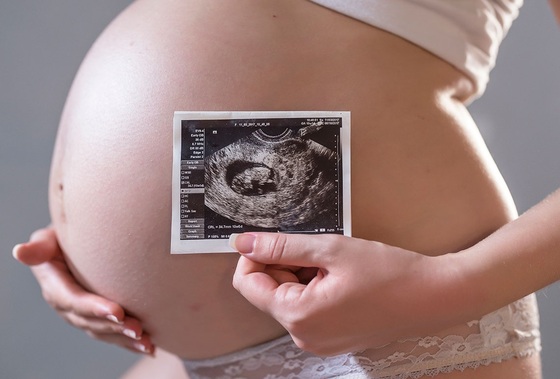 as fases da gravidez - Foto: Dragana_Gordic / Freepik