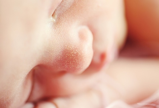 A Síndrome do bebê sacudido - Foto: TawnyNina / pixabay.com
