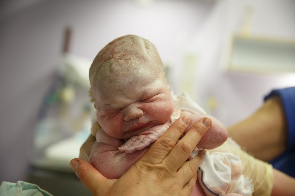 Bebê recém-nascido imediatamente após o parto - foto: zlikovec/ShutterStock.com