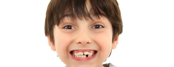 Criança sorrindo com um dente faltando - Foto: Jaimie Duplass/ShutterStock.com