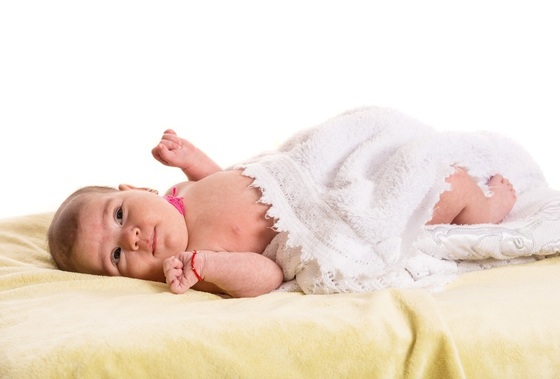 Bebê com torcicolo congênito - foto: Blaj Gabriel/ShutterStock.com