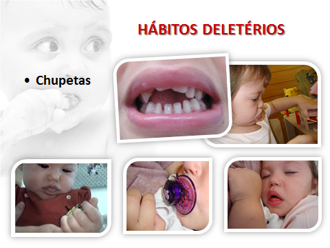 Hábitos deletérios - uso da chupeta - Foto: Prof. Dra. Silvia Chedid