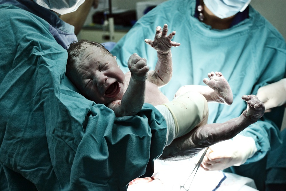 Recém-nascido chorando - Foto: esmo/Shutterstock.com